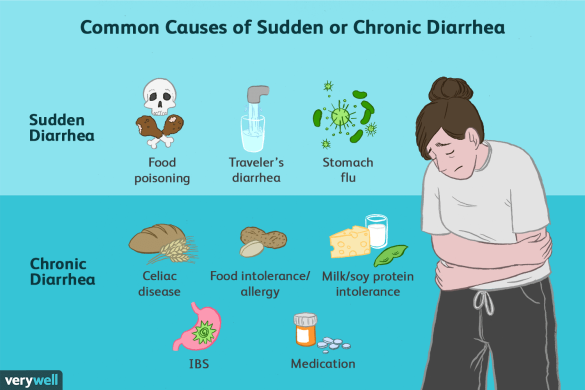 What Is Diarrhea?